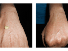 NeriumAD Age-Defying Treatment Review